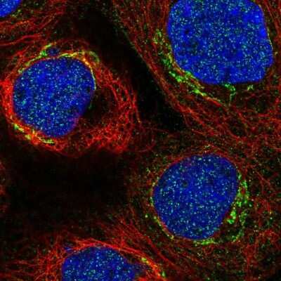 Immunocytochemistry/ Immunofluorescence: C3orf67 Antibody [NBP2-57722]