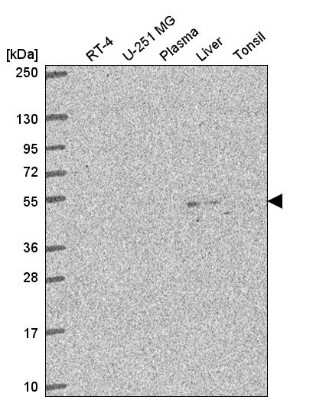 Western Blot: C3orf67 Antibody [NBP2-57722]