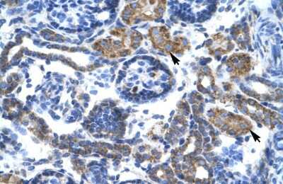 Immunohistochemistry-Paraffin: C4 binding protein B Antibody [NBP1-58983]
