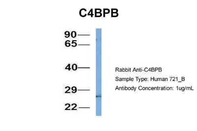 Western Blot: C4 binding protein B Antibody [NBP1-58983]
