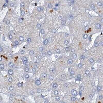 Immunohistochemistry-Paraffin: C4.4A/LYPD3 Antibody [NBP2-32598]