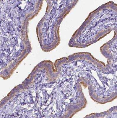 Immunohistochemistry-Paraffin: CFAP299 Antibody [NBP1-86203]