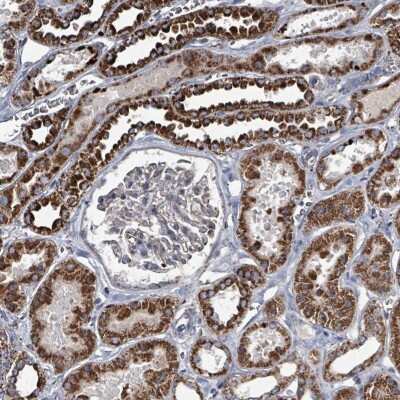 Immunohistochemistry-Paraffin: ABHD18 Antibody [NBP2-30555]