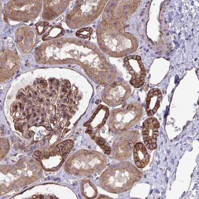Immunohistochemistry-Paraffin: C4orf36 Antibody [NBP2-31678]