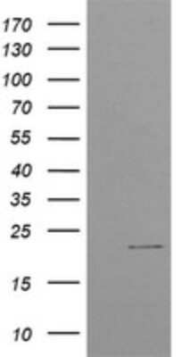 Western Blot: CTBP1-DT Antibody (OTI4F2) [NBP2-45585]