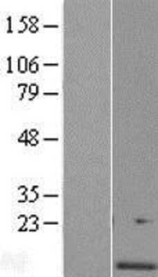 Western Blot: RCDG1 Overexpression Lysate [NBL1-12584]