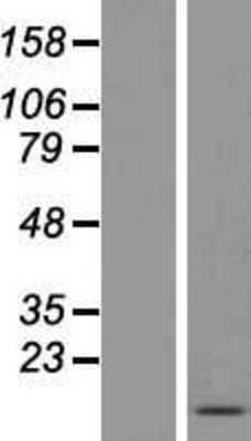 Western Blot: FDCSP Overexpression Lysate [NBL1-08481]