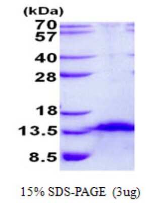 SDS-PAGE: Recombinant Human FDCSP His Protein [NBP2-23054]