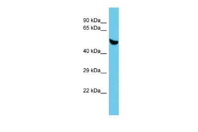 Western Blot: C5orf22 Antibody [NBP2-82924]