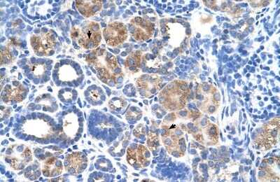 Immunohistochemistry-Paraffin: C5orf4 Antibody [NBP1-60125]