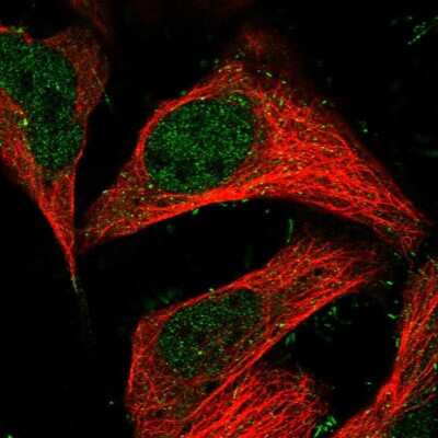 Immunocytochemistry/ Immunofluorescence: TRAPPC13 Antibody [NBP1-94021]