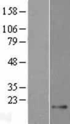 Western Blot: TEX43 Overexpression Lysate [NBP2-04498]