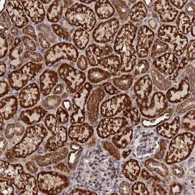 Immunohistochemistry-Paraffin: C5orf49 Antibody [NBP2-14530]