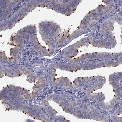Immunohistochemistry-Paraffin: C5orf49 Antibody [NBP2-14530]