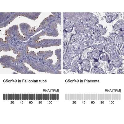 Immunohistochemistry-Paraffin: C5orf49 Antibody [NBP2-14530]