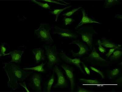 Immunocytochemistry/ Immunofluorescence: C5orf51 Antibody [H00285636-B01P]