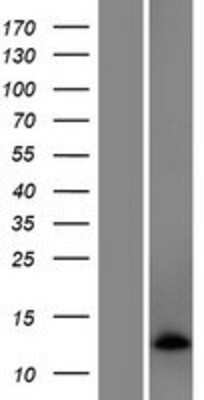 Western Blot: EXOC3-AS1 Overexpression Lysate [NBP2-05651]