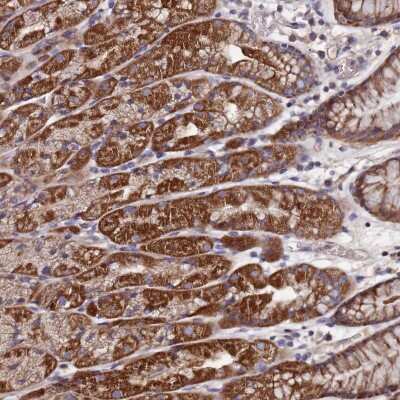 Immunohistochemistry-Paraffin: C5orf63 Antibody [NBP2-48787]
