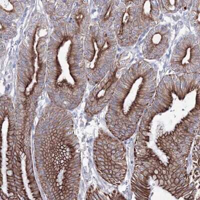 Immunohistochemistry: SMIM29 Antibody [NBP2-48676]