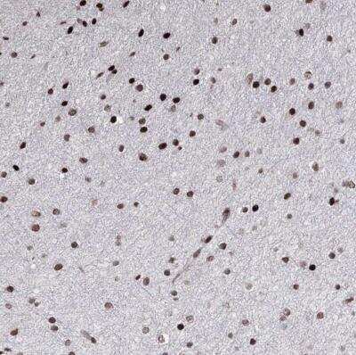 Immunohistochemistry-Paraffin: SMIM29 Antibody [NBP1-81323]