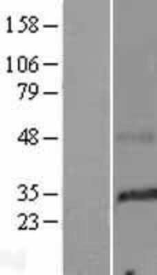 Western Blot: SMIM29 Overexpression Lysate [NBP2-08795]