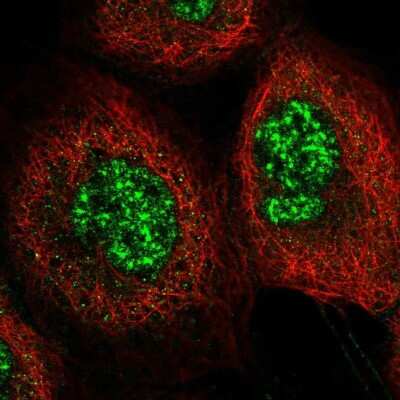 Immunocytochemistry/ Immunofluorescence: C6orf106 Antibody [NBP2-48623]