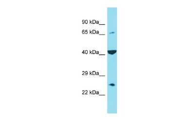 Western Blot: C6orf120 Antibody [NBP2-82926]