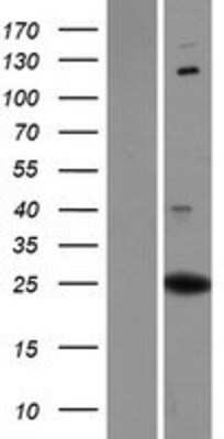 Western Blot: PXDC1 Overexpression Lysate [NBP2-04786]