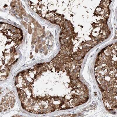 Immunohistochemistry-Paraffin: CEP85L Antibody [NBP1-90778]