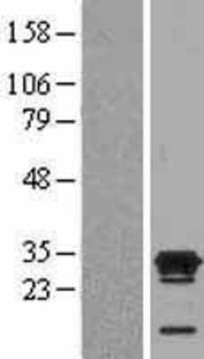 Western Blot: ECAT1 Overexpression Lysate [NBL1-08528]