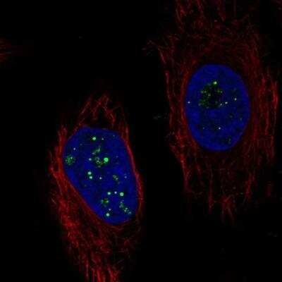 Immunocytochemistry/ Immunofluorescence: C6orf223 Antibody [NBP2-76532]
