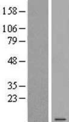 Western Blot: C6orf48 Overexpression Lysate [NBL1-08532]