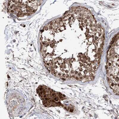 Immunohistochemistry-Paraffin: SDHAF4 Antibody [NBP1-86324]