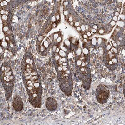 Immunohistochemistry-Paraffin: SDHAF4 Antibody [NBP1-86324]