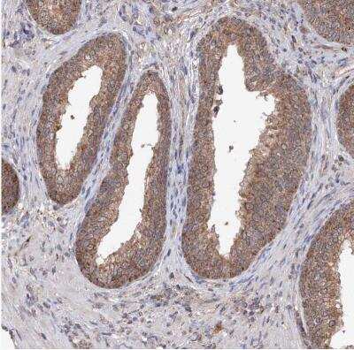 Immunohistochemistry-Paraffin: SDHAF4 Antibody [NBP1-86324]