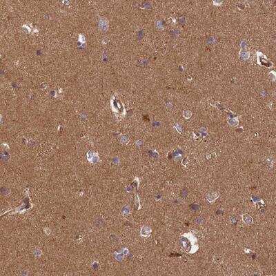 Immunohistochemistry: ERMARD Antibody [NBP1-90580]