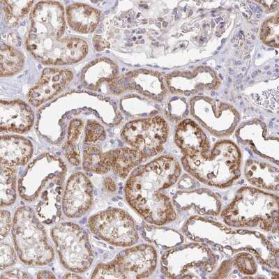 Immunohistochemistry: GPALPP1 Antibody [NBP2-38489]
