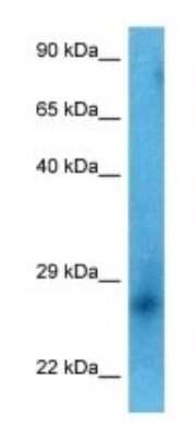 Western Blot: C6orf99 Antibody [NBP3-09915]