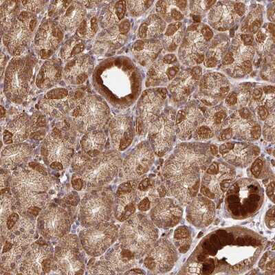Immunohistochemistry-Paraffin: MALSU1 Antibody [NBP2-33639]