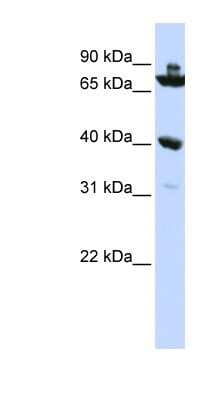 Western Blot: C7orf31 Antibody [NBP1-56351]