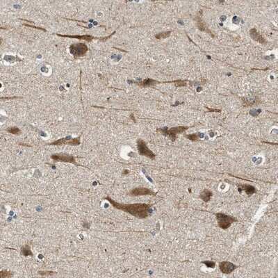Immunohistochemistry-Paraffin: YAE1 Antibody [NBP1-81830]