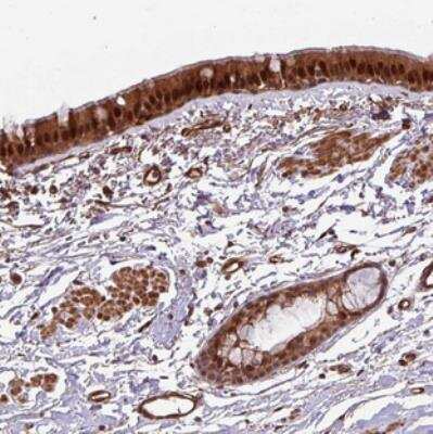 Immunohistochemistry-Paraffin: C7orf50 Antibody [NBP2-30873]