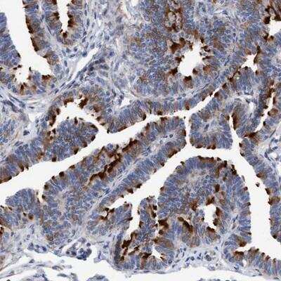 Immunohistochemistry: C7orf57 Antibody [NBP1-91074]