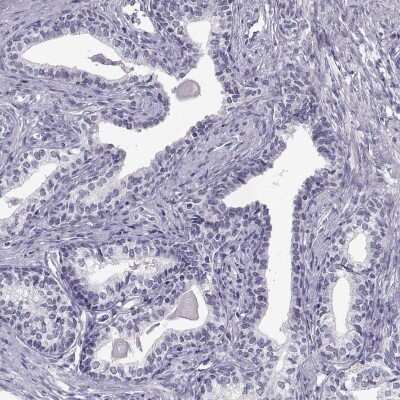 Immunohistochemistry-Paraffin: C7orf61 Antibody [NBP2-32540]