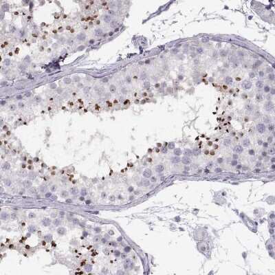 Immunohistochemistry-Paraffin: C7orf61 Antibody [NBP2-32540]