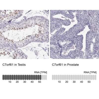 Immunohistochemistry-Paraffin: C7orf61 Antibody [NBP2-32540]