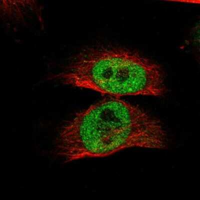 Immunocytochemistry/ Immunofluorescence: RBM48 Antibody [NBP1-84150]