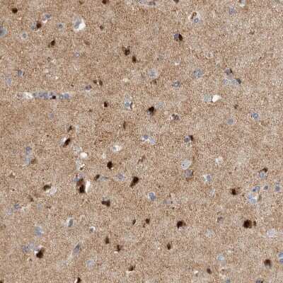 Immunohistochemistry-Paraffin: RBM48 Antibody [NBP1-85077]