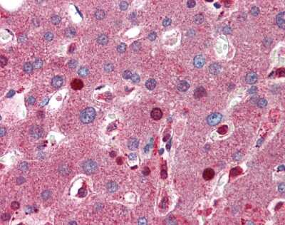 Immunohistochemistry: C8B Antibody [NBP2-87104]