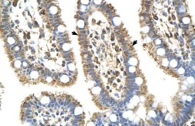 Immunohistochemistry-Paraffin: C8B Antibody [NBP1-70481]
